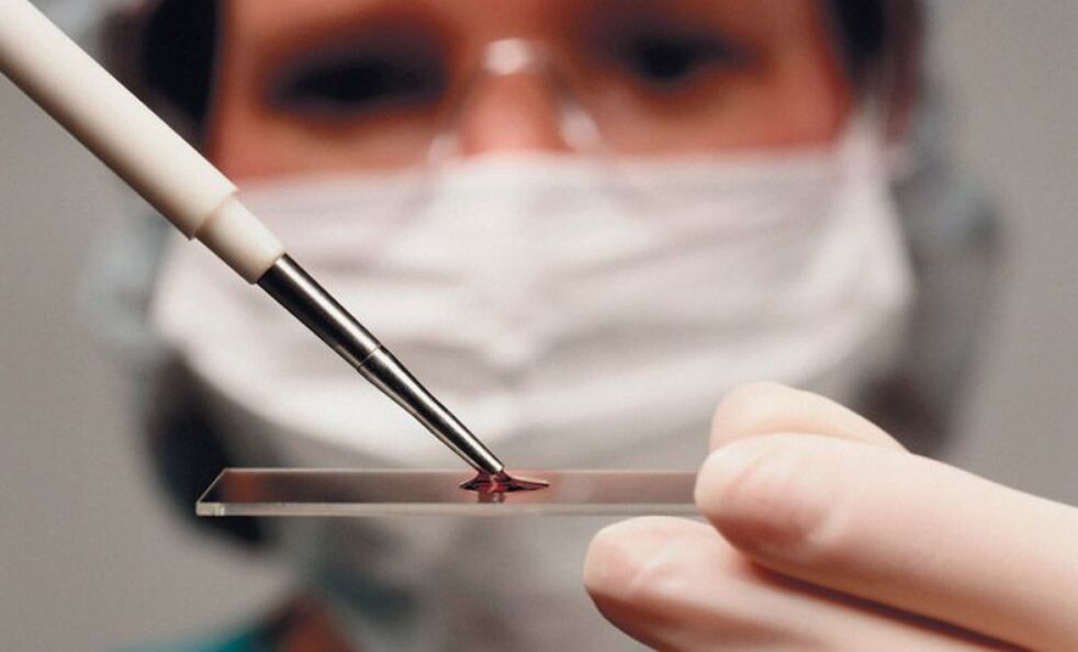 blood test for parasites