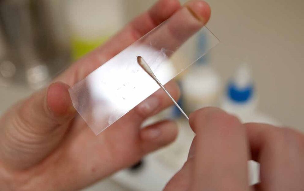 scraping for the presence of parasites in the body