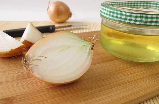 Onion infusion to remove worms, used for one week